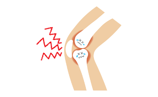 膝蓋大腿関節の異常（膝蓋骨不安定症など）